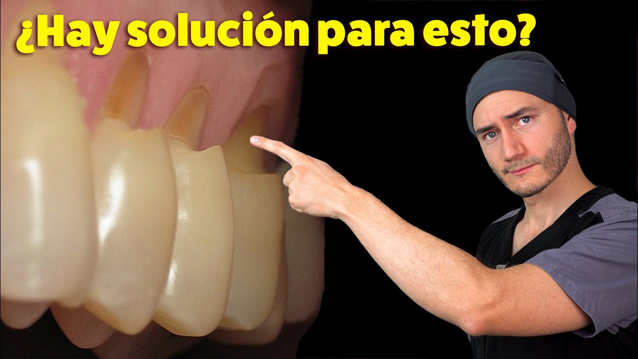 se pueden arreglar los dientes podridos