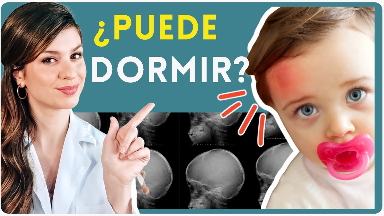 mi bebe se golpeo la cabeza