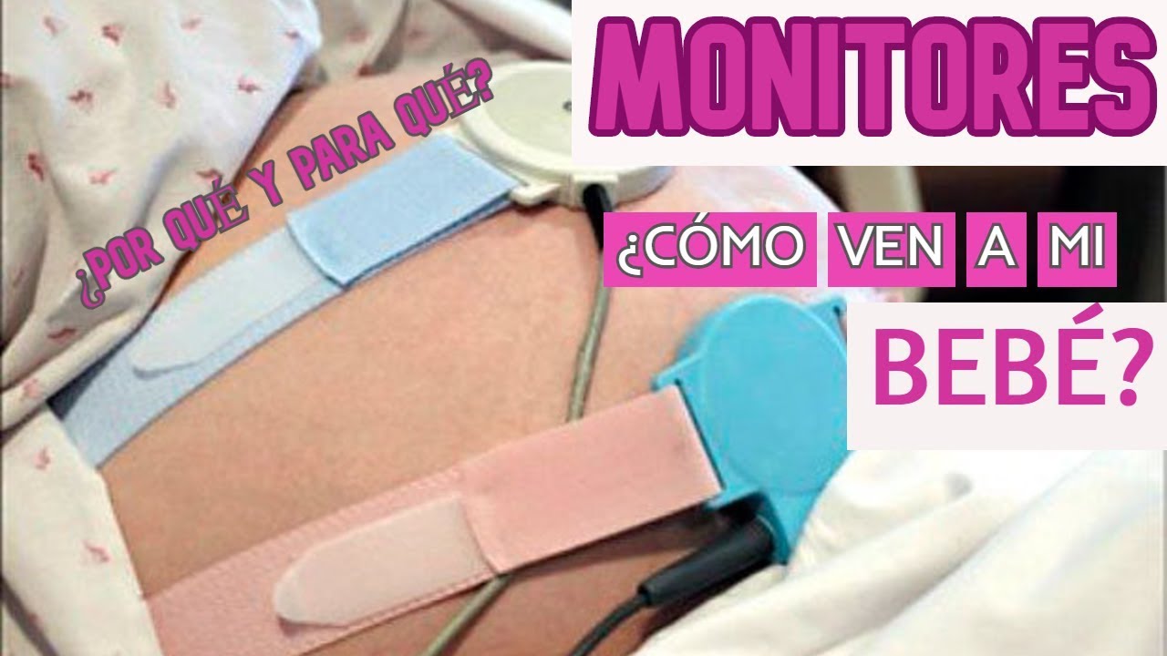para que sirven los monitores en el embarazo
