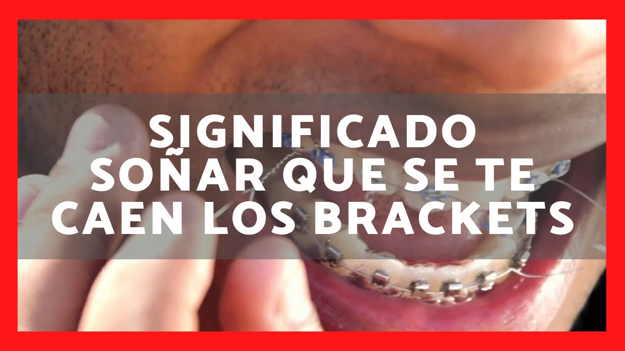 que significa soñar que se te caen los brackets